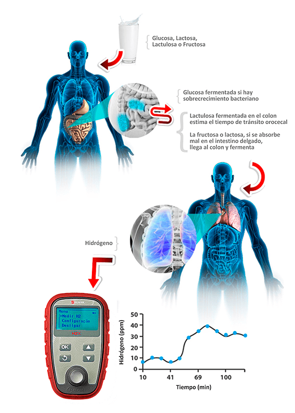 Test Respiratorio de Hidrógeno Exhalado